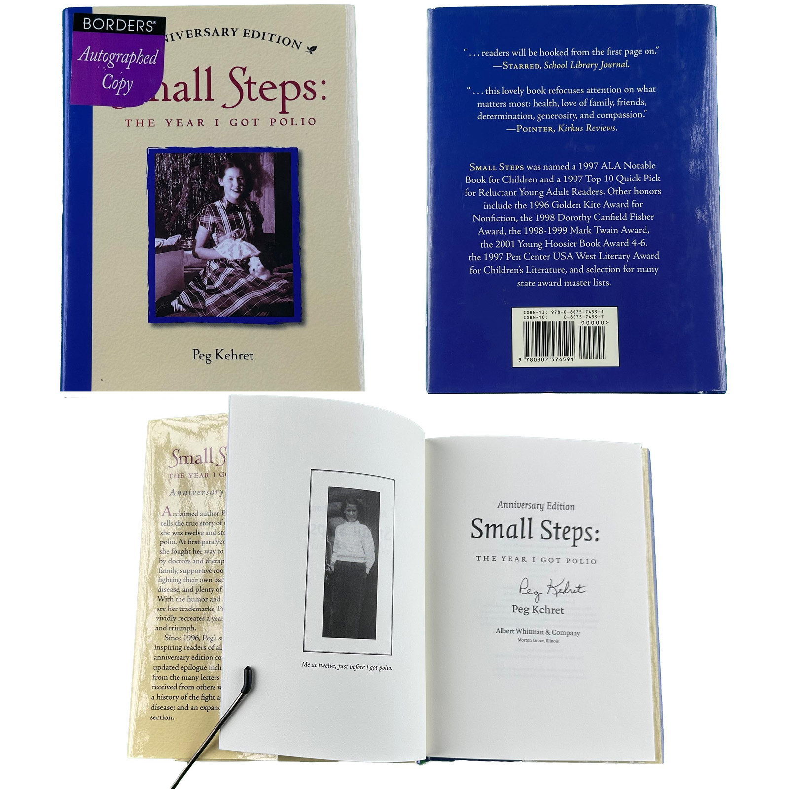 Small Steps: The Year I Got Polio (Anniversary Edition, Autographed Copy)