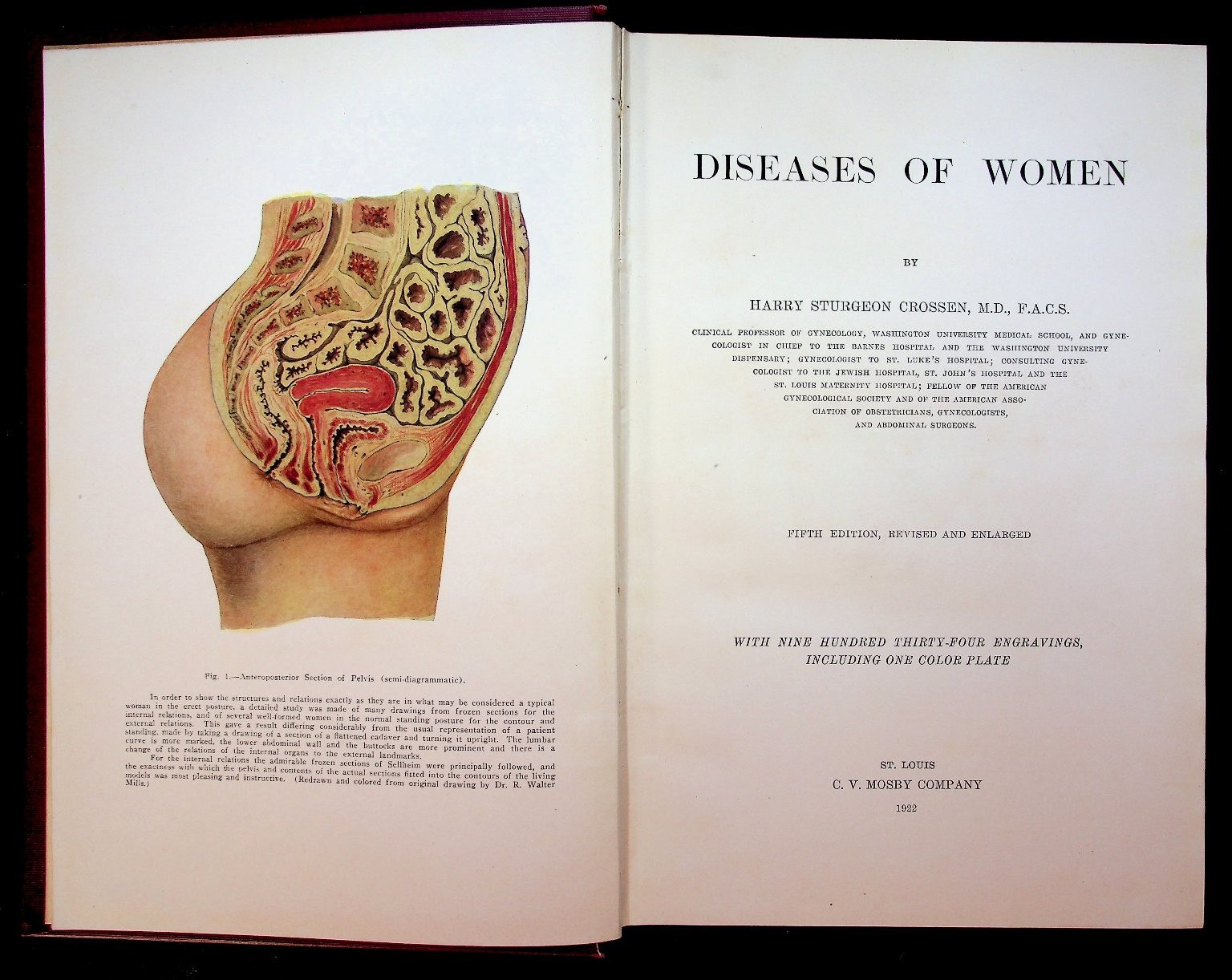Diseases of Women Harry Sturgeon Crossen 1922 5th Edition Medical C.V. Mosby